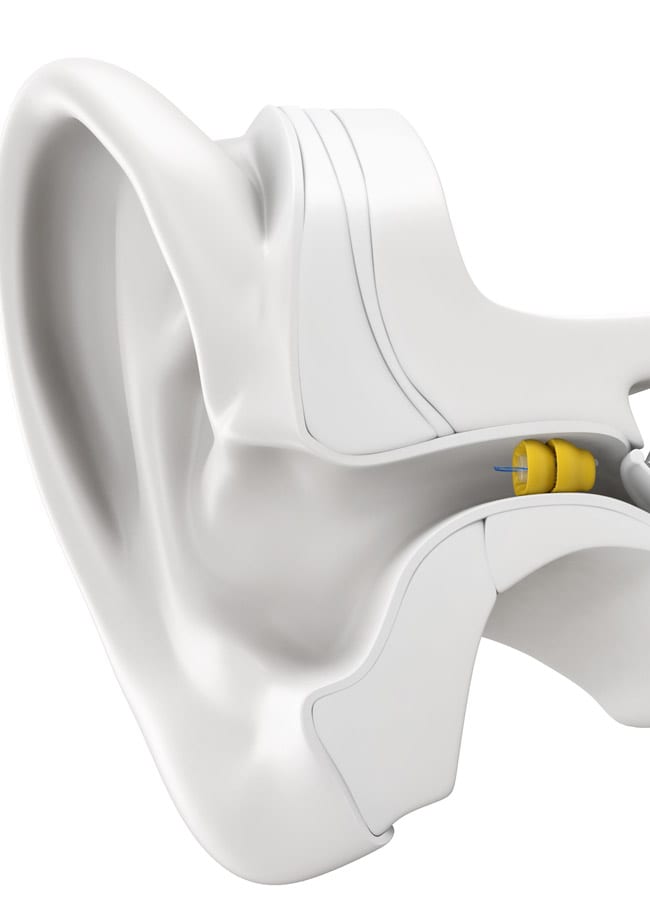 phonak hearing aid diagram visual